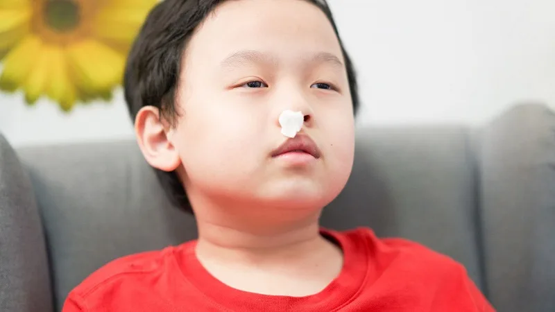 Những sai lầm cần tránh khi bị chảy máu cam
