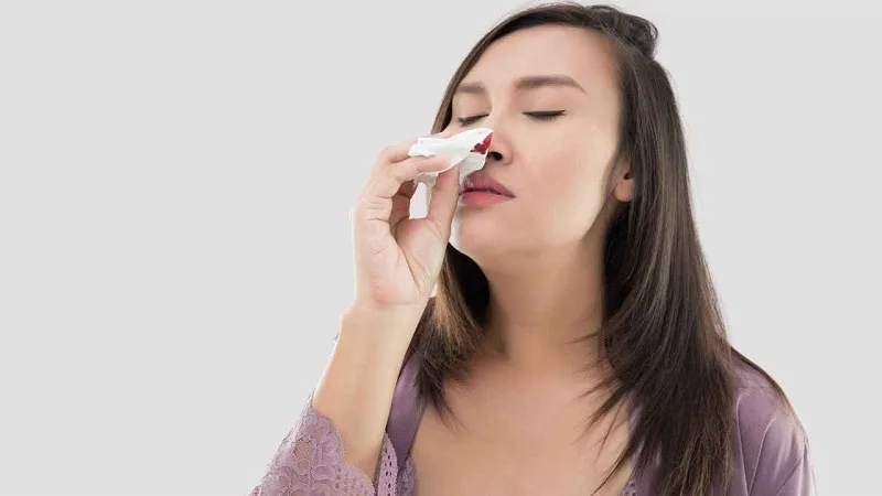 Chảy máu cam nên làm gì để cầm máu nhanh và an toàn?
